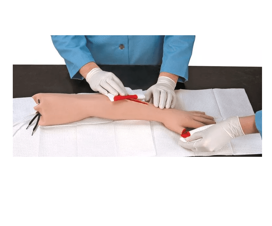 Blutstillungs - Arm - Erler - Zimmer